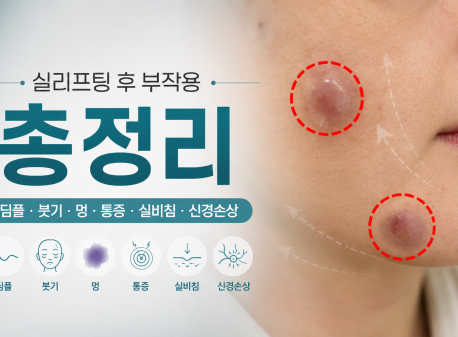 thread-lifting-complications