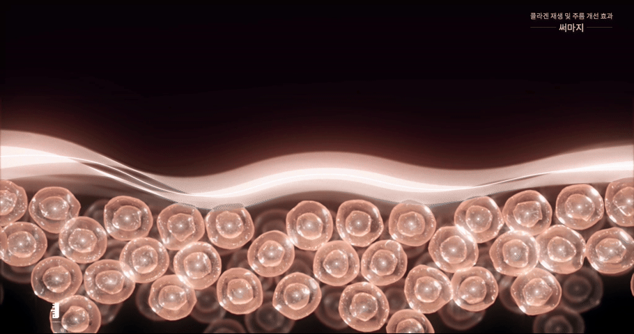 Triple-Layer Tightening Effect