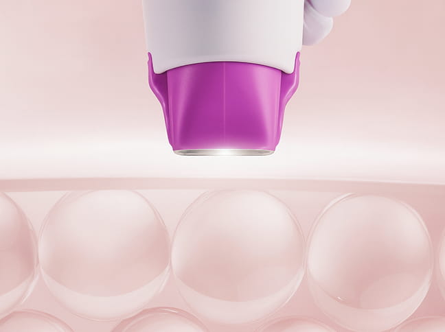 실시간 임피던스 분석