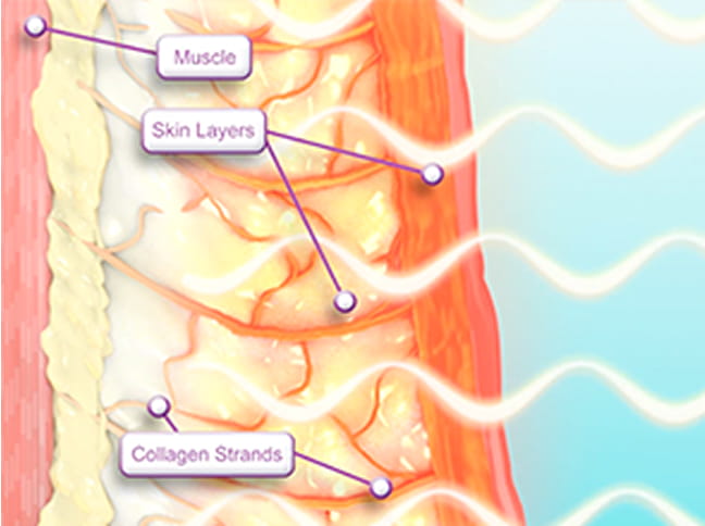 고밀도 에너지 설계