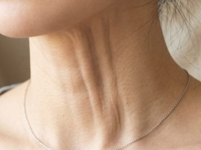 세로 목주름 탄력